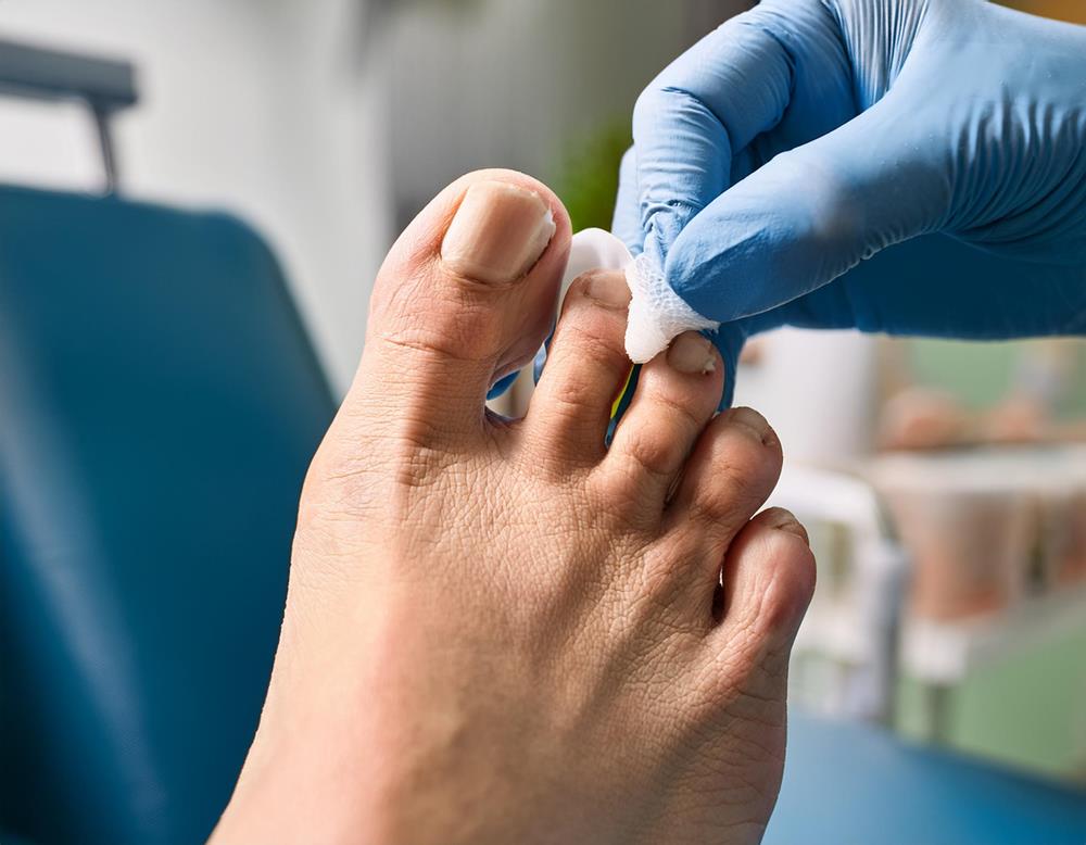 Firefly podiatry treatment with a close-up of calluses 5249